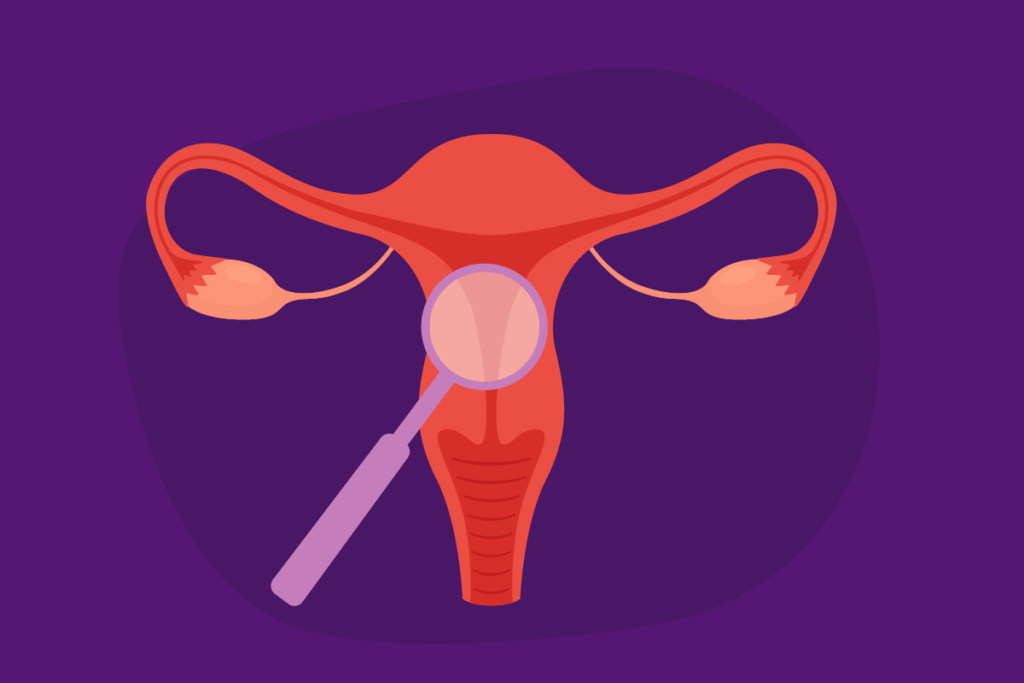 Who Makes Up a Uterine Health Condition Team?