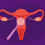 Who Makes Up a Uterine Health Condition Team?