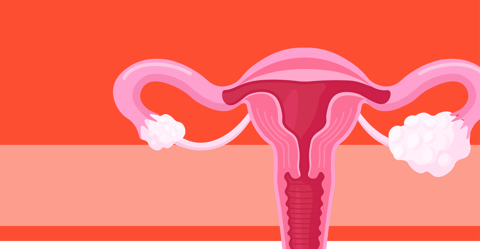 How PCOS Affects Your Body