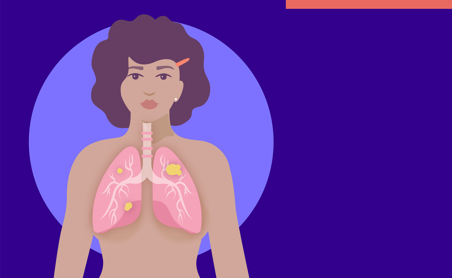 Women Who Have Never Smoked Can Get Lung Cancer