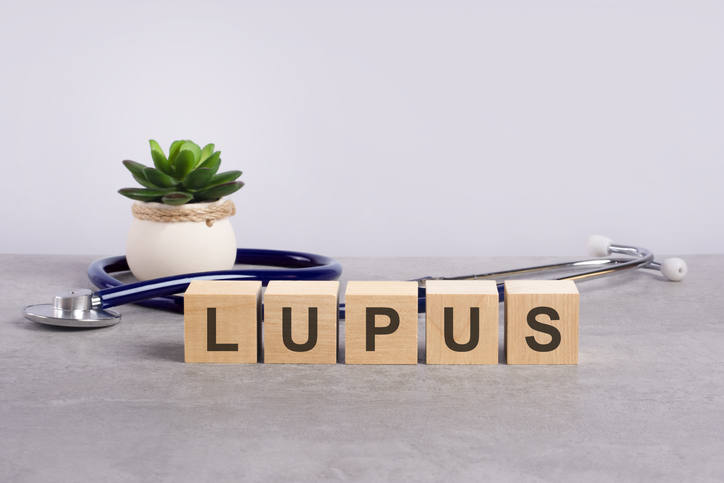 wooden block form the word Lupus with stethoscope on the doctor's desktop